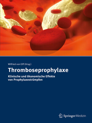 cover image of Thromboseprophylaxe Klinische und ökonomische Effekte von Prophylaxestrümpfen